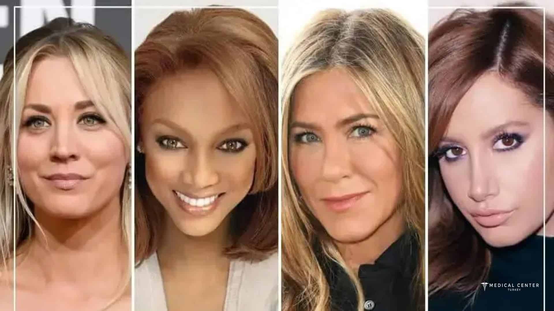 10 Celebrity Rhinoplasty Results