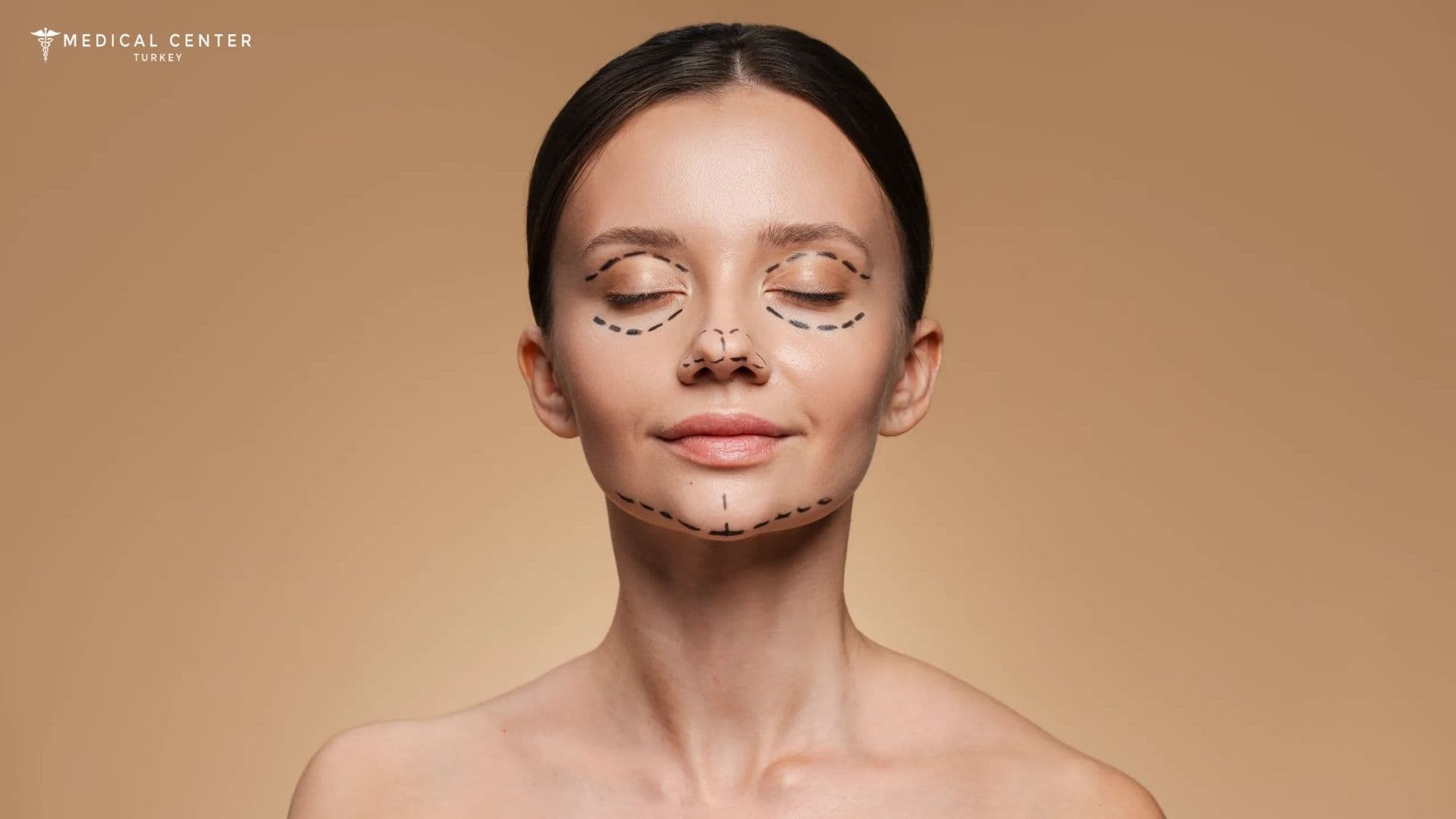 3D Rhinoplasty Surgery Cost in Turkey