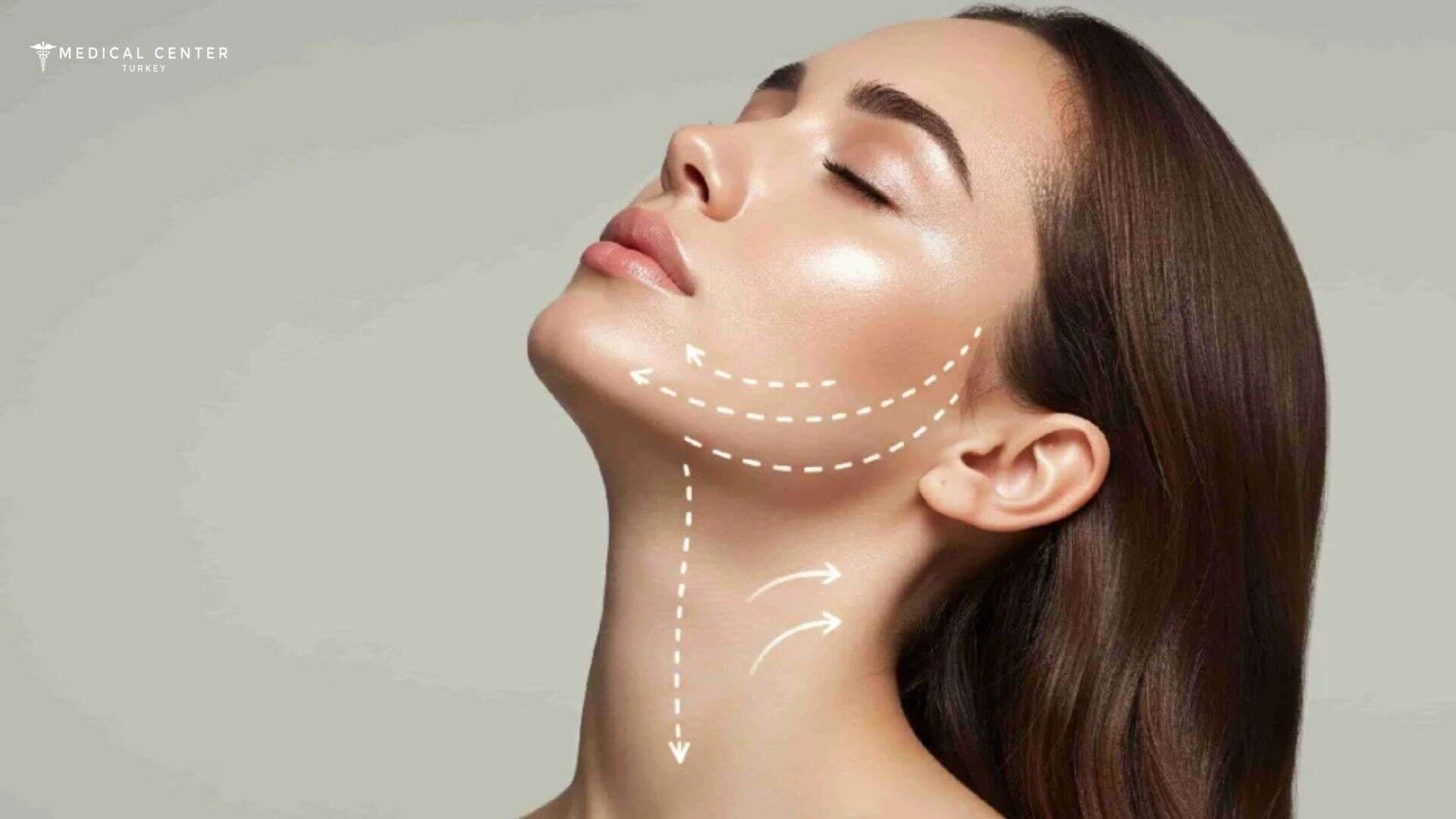 A Solution for a Youthful Neckline in Turkey