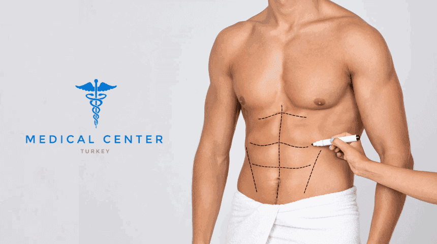 A Complete Guide to Liposuction for Men