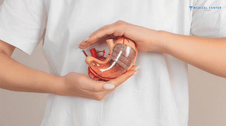Advantages of a Gastric Bypass in Turkey