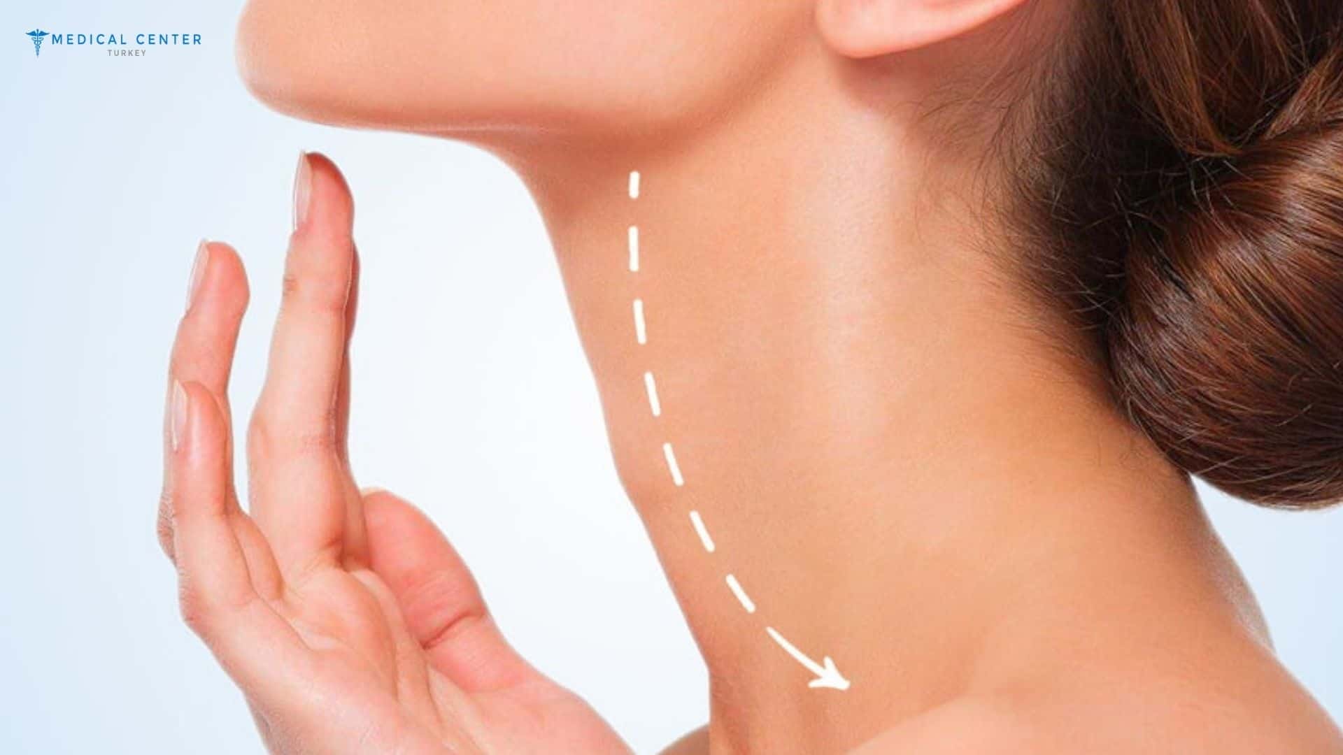 Are Neck lift in Turkey Worth the Trip?