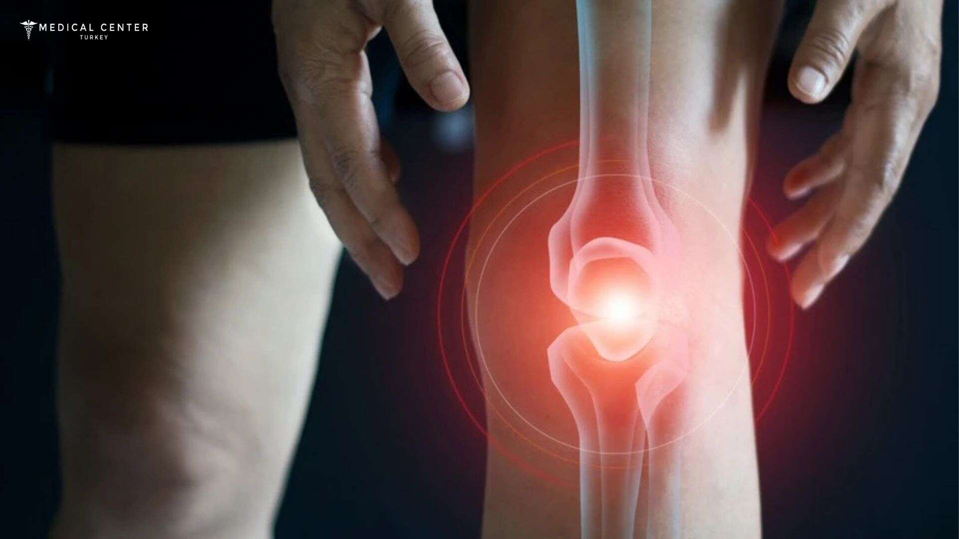 Athlete Meniscus Repair in Turkey