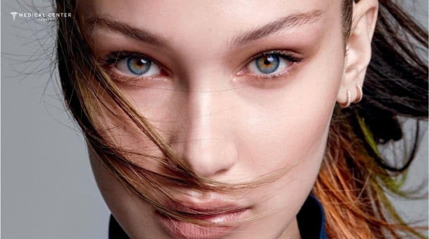 Bella Eyes Surgery in Turkey