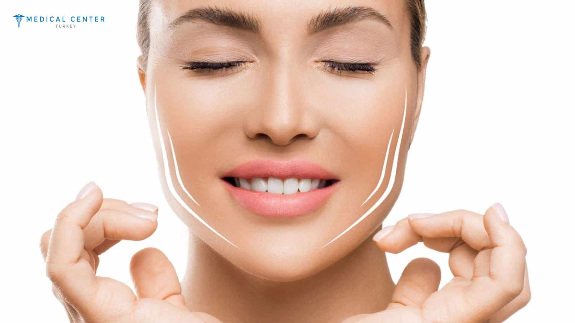 Bichectomia: What You Need to Know About Facial Sculpting