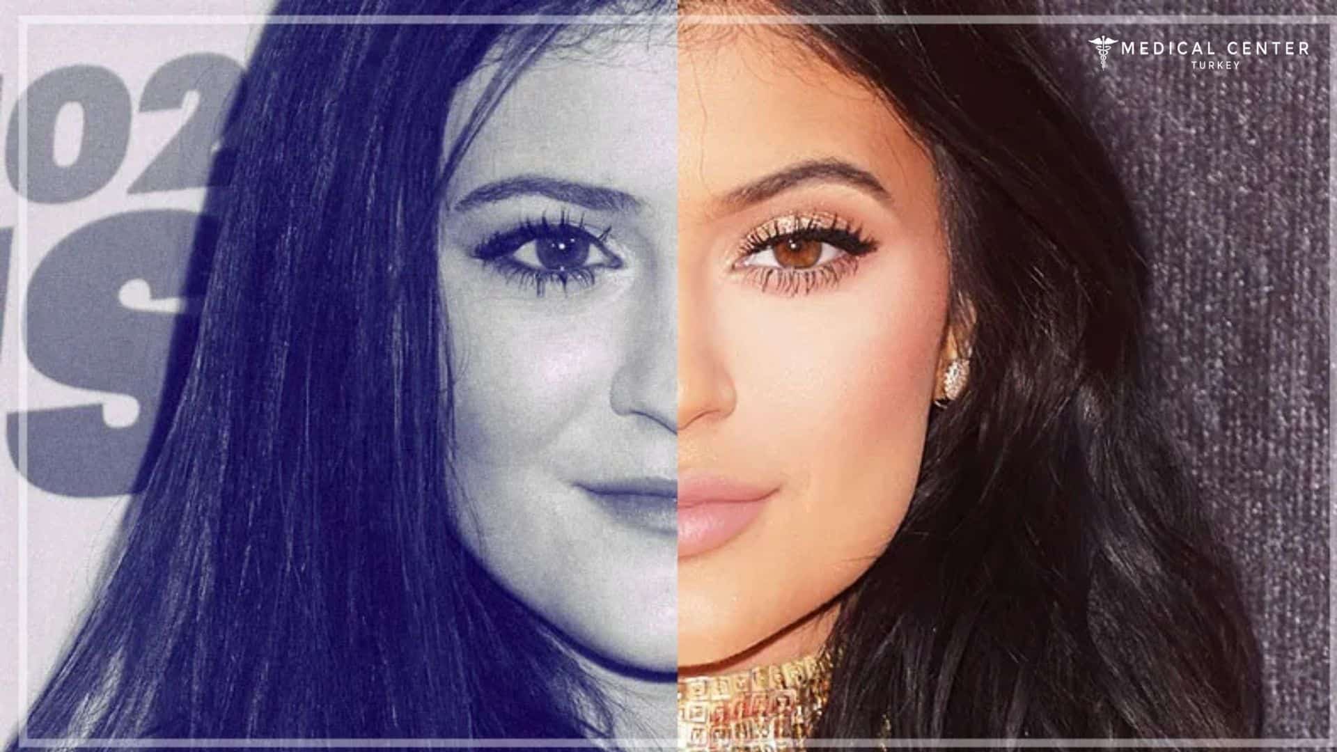 Big Transformation of Kylie Jenner