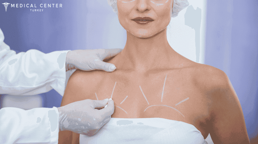 Breast Lift in Turkey