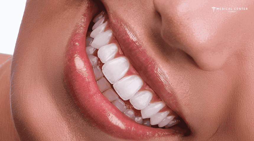 Can I Fix My Smile in Just One Trip to Turkey?