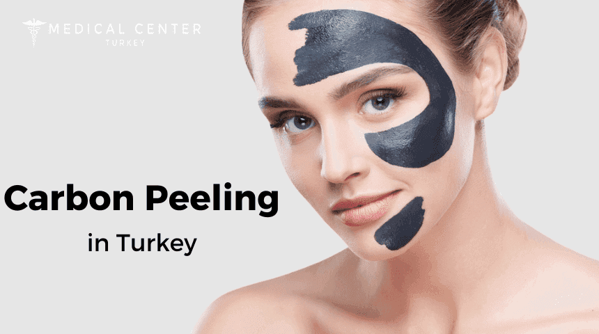 Carbon Peeling In Turkey