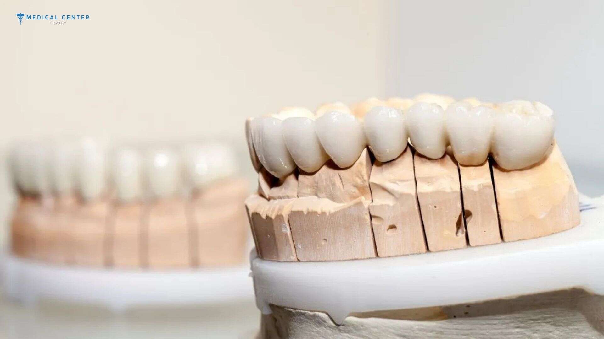Dental Crowns in Turkey