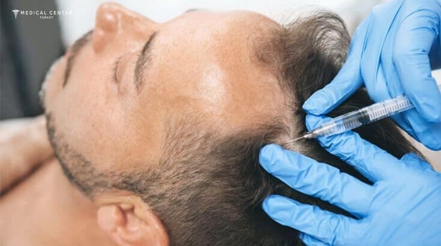 DHI Plus Gold Hair Transplantation in Turkey