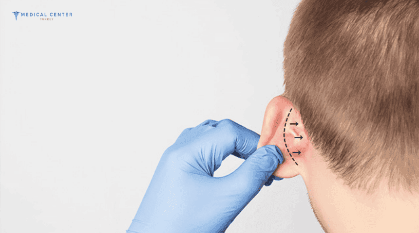 Ear Correction Surgery in Turkey