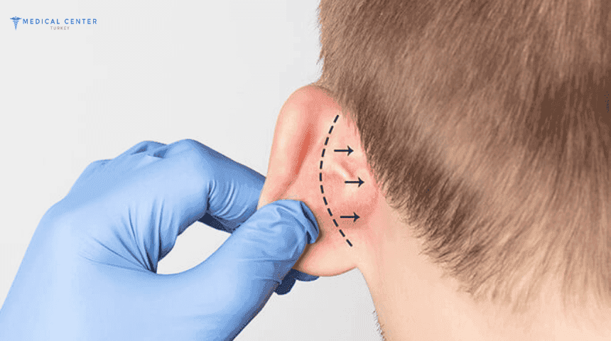 Ear Correction Surgery (Otoplasty) Who Is a Good Candidate?