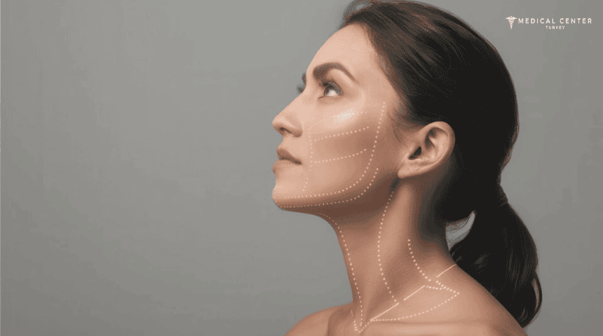 Expectations of Neck Lift Surgery in Turkey