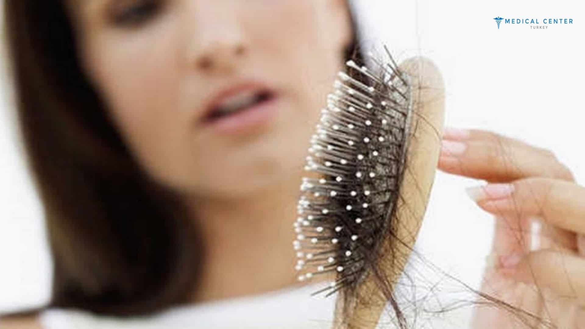 Female Hair Transplants: All You Need To Know