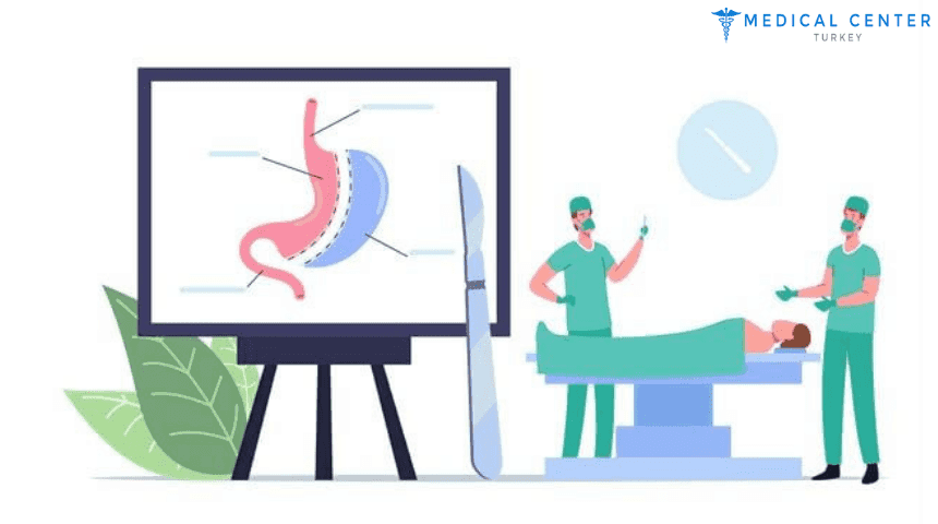 Gastric Sleeve Operation in Turkey