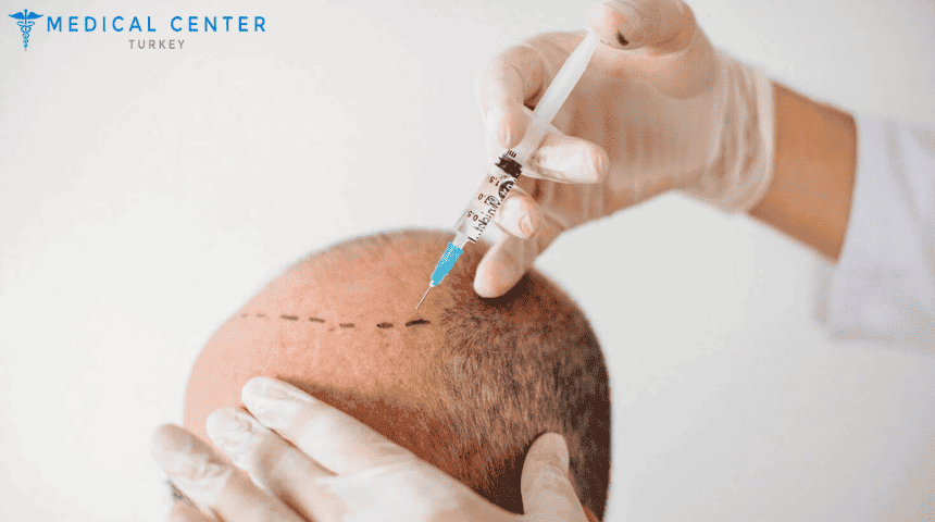 Hair Transplant Cost U.S. vs Turkey