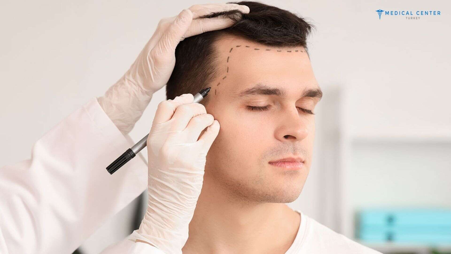 Hair Transplant in Turkey: Best Doctors