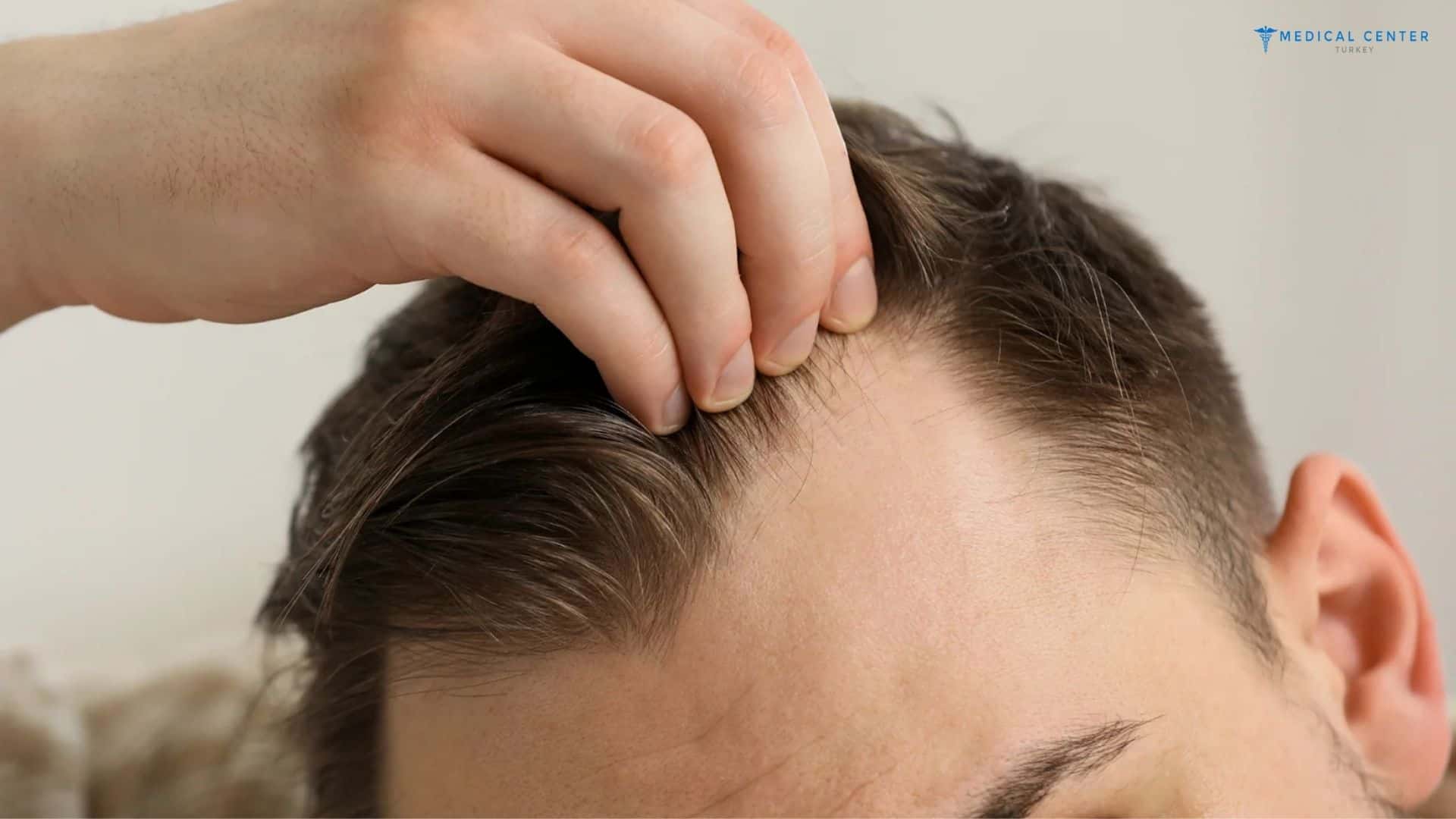 Hair Transplant Techniques Explained Step by Step