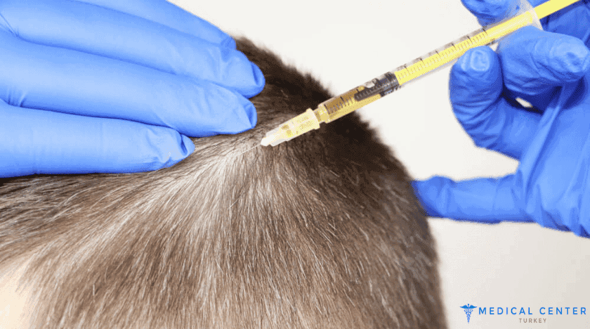 Hair Treatment Mesotherapy