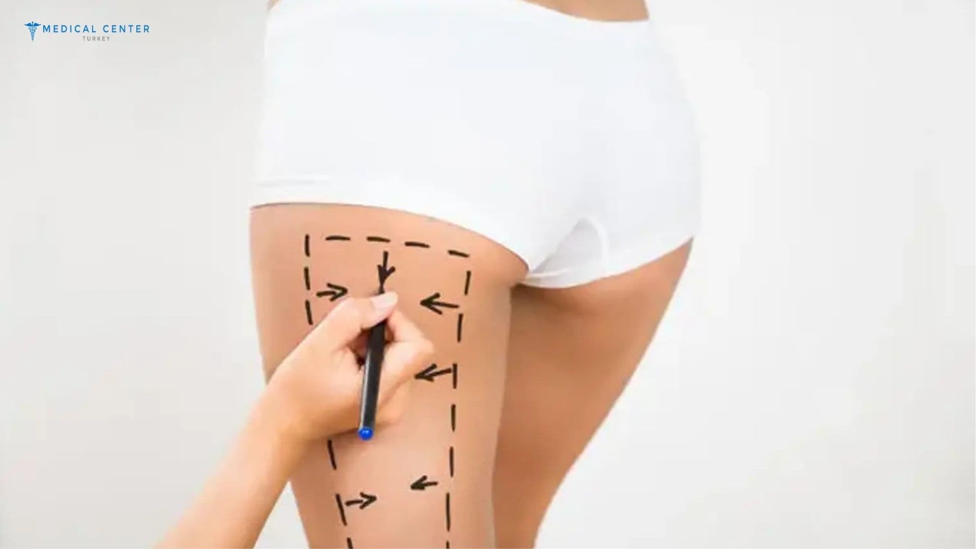 Hip Lift Surgery in Turkey
