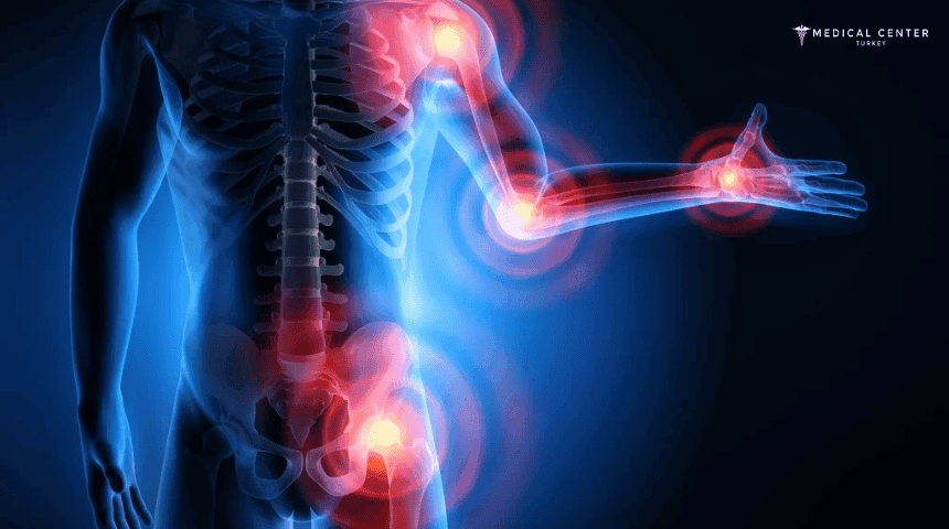 How is spinal osteoarthritis treated in Turkey?