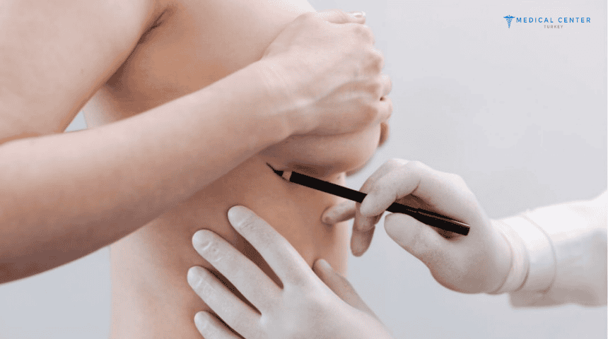 How Much Does a Complete Breast Augmentation Package Cost in Turkey?