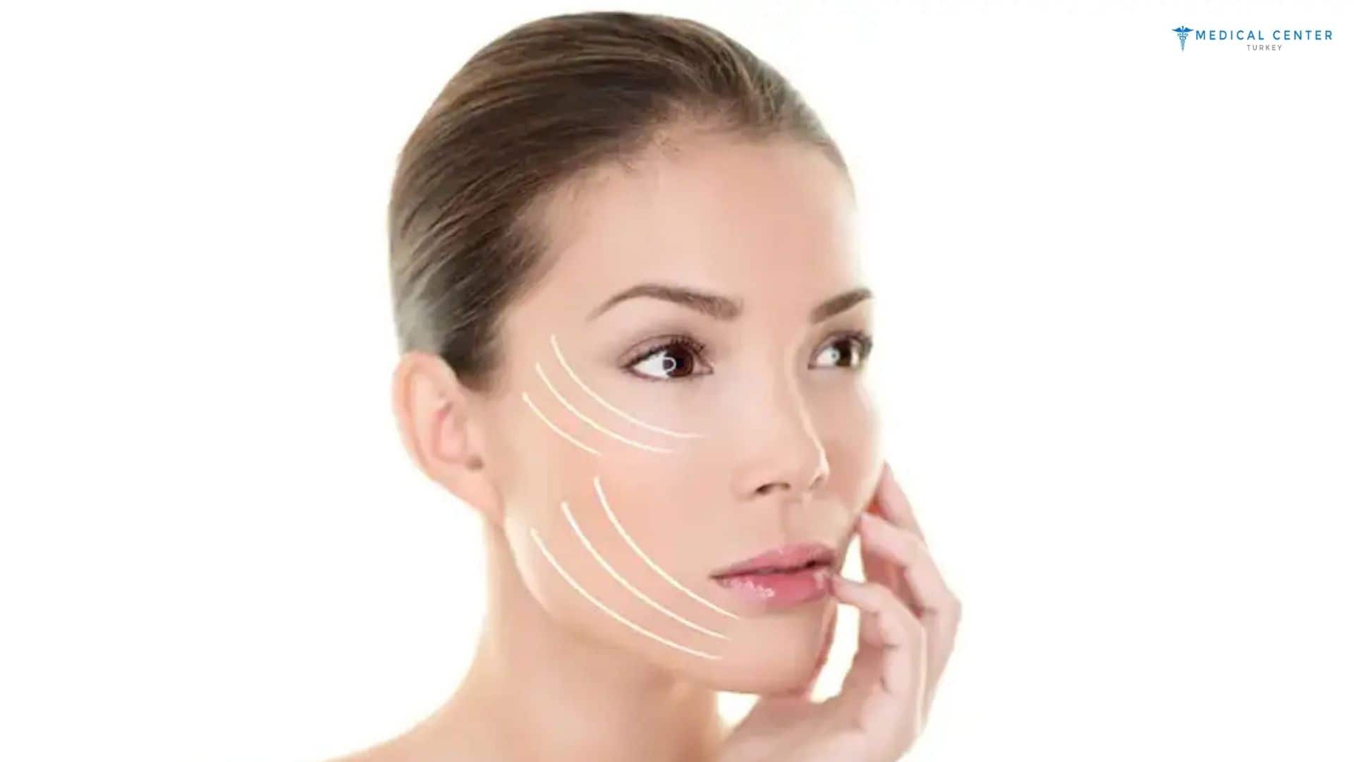How Much is Facelift in Turkey?