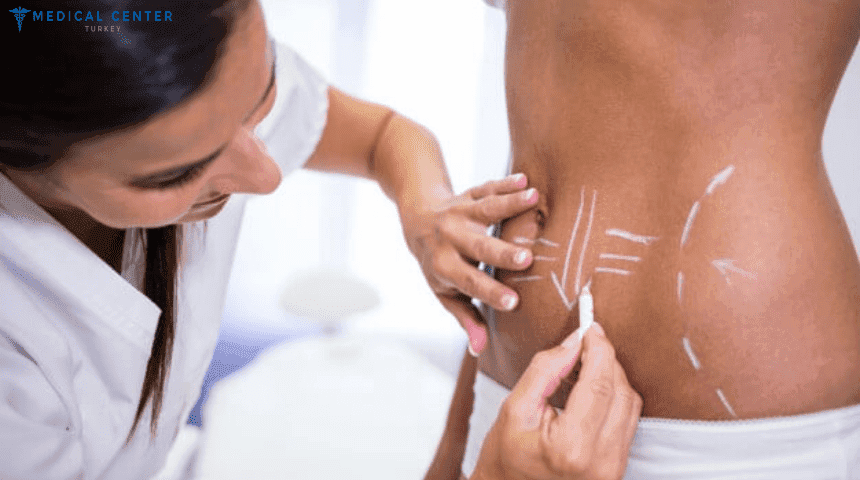 How much is liposuction in Turkey?