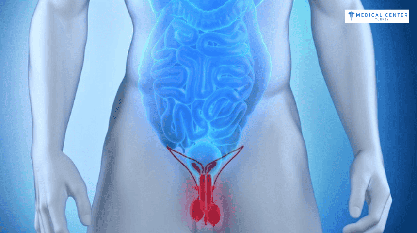 How Testicular Cancer is Treated?