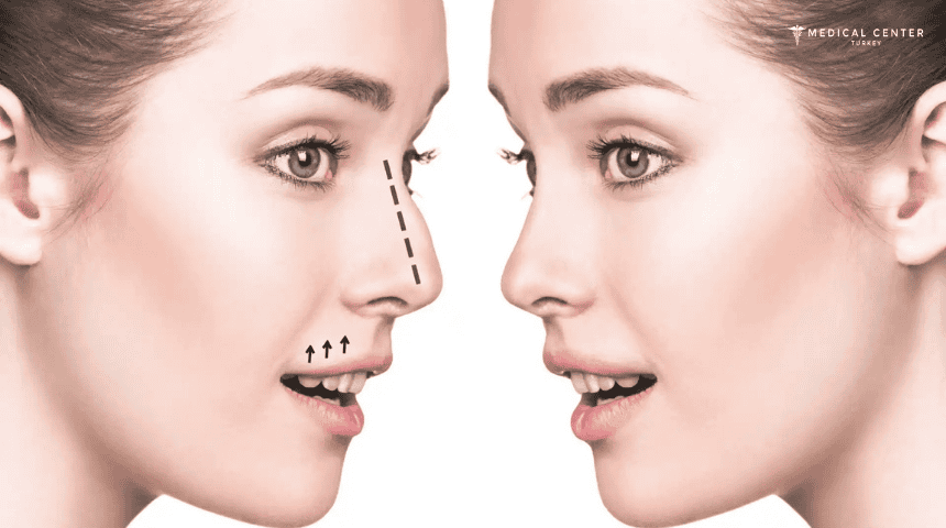 How To Make The Nose Smaller Naturally?
