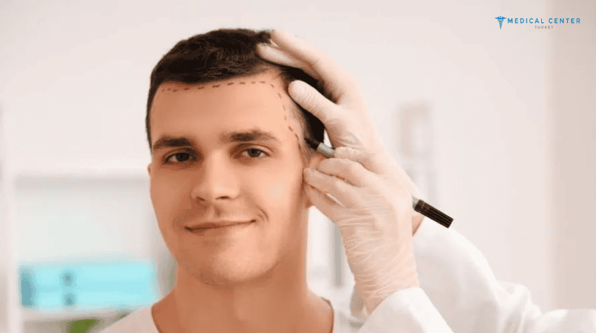How To Maximize Hair Transplant Results?