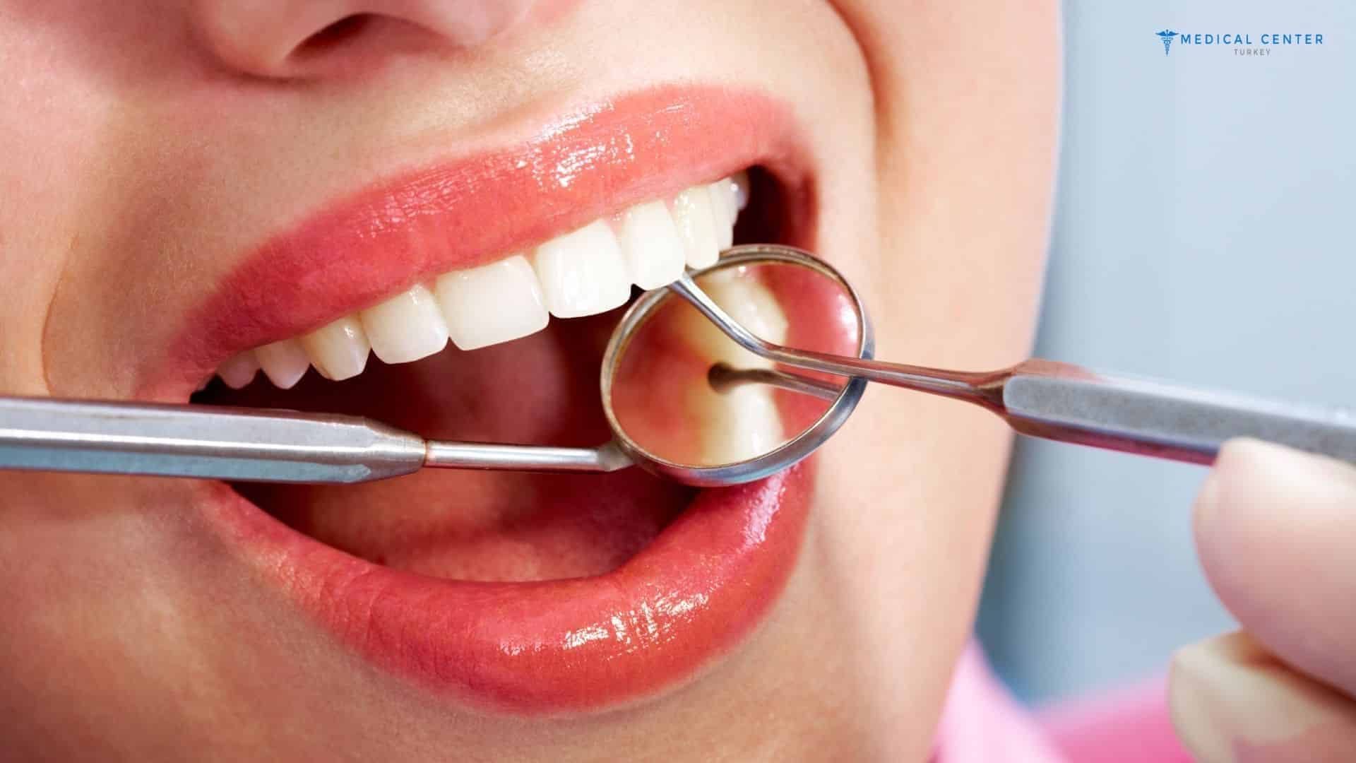Is Dental Treatment Reliable?
