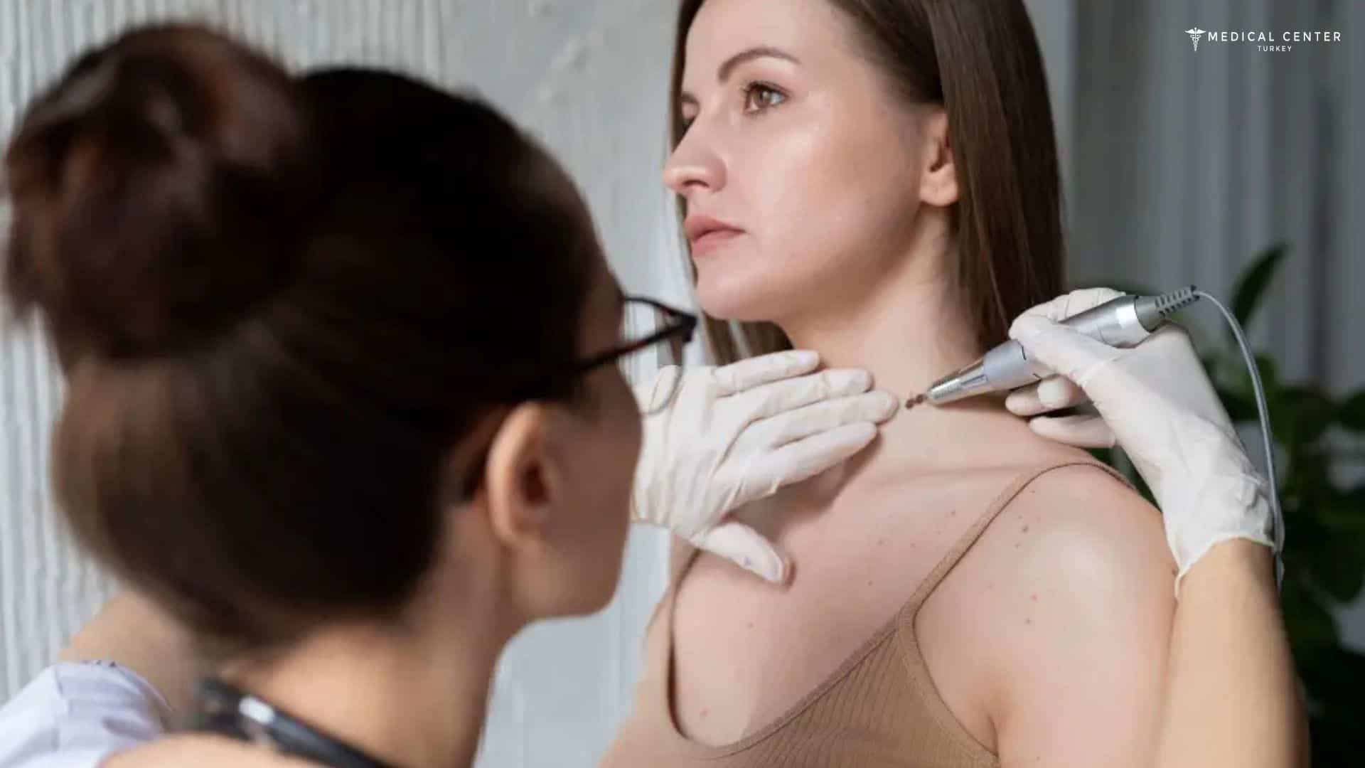 Is Mole Removal in Turkey Safe and Affordable?