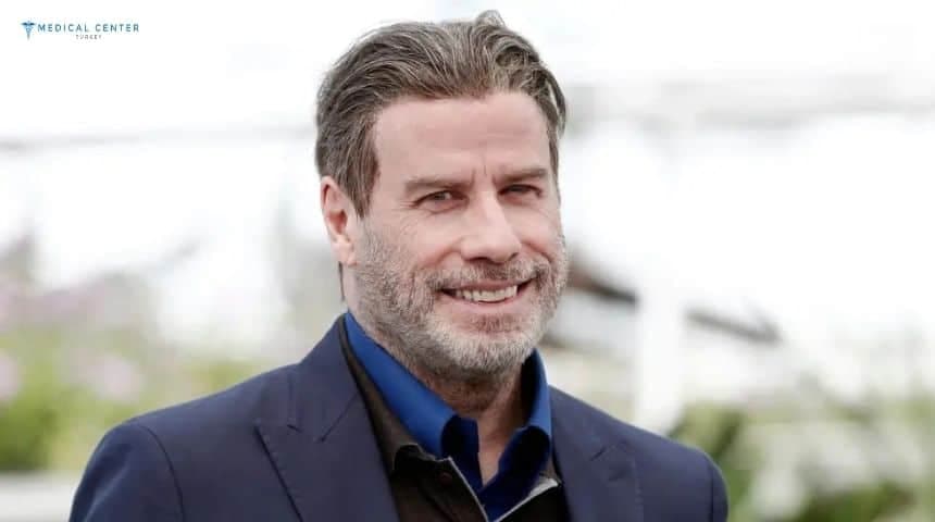 John Travolta's Hair Transplantation