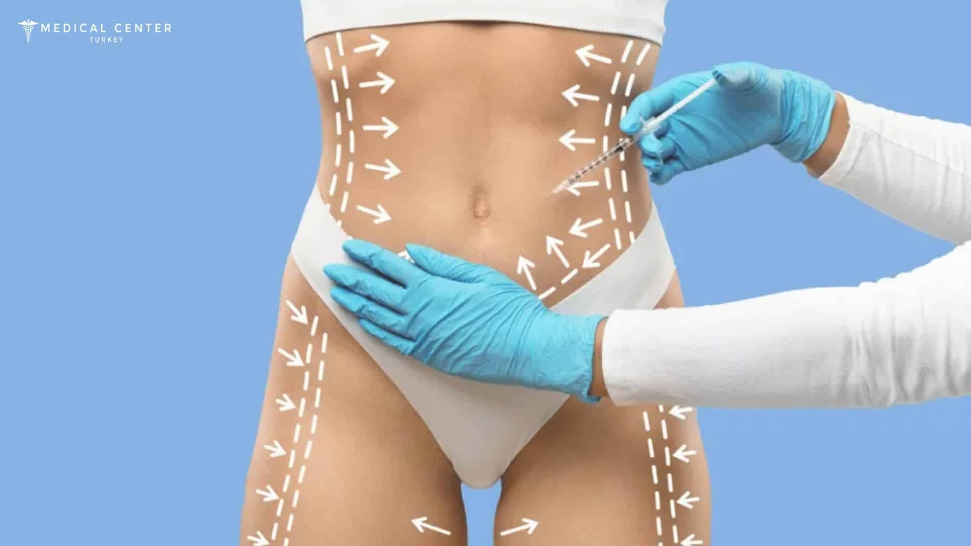 Laser Lipo vs. Vaser Lipo: Which is Better?