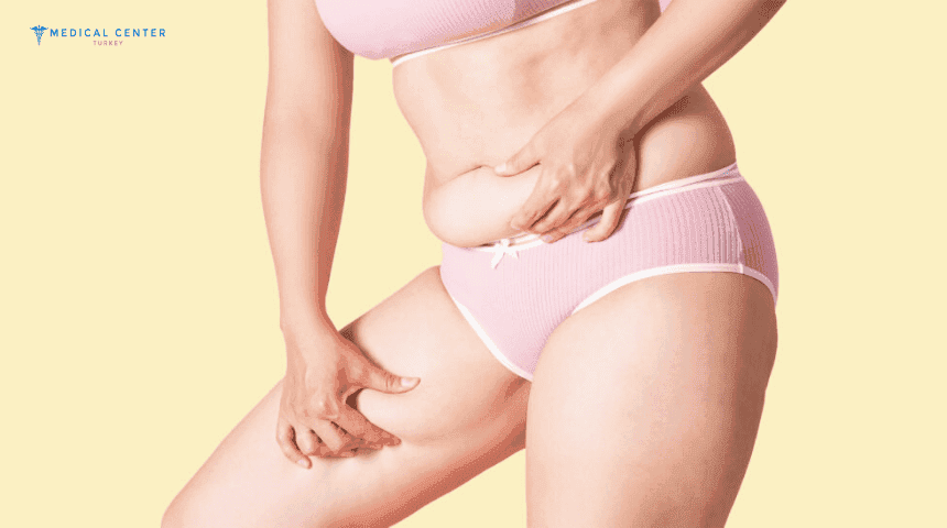 Maintaining Liposuction Result Tips and Lifestyle Advice
