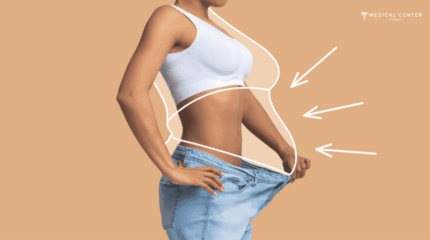 Medical Tourism: Weight Loss Surgery Abroad?