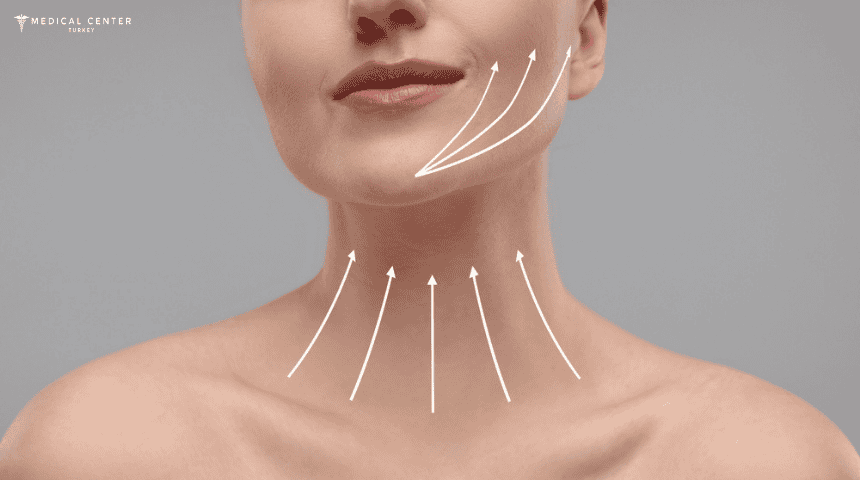 Neck Lift Surgery: Solution for a Youthful Neckline in Turkey