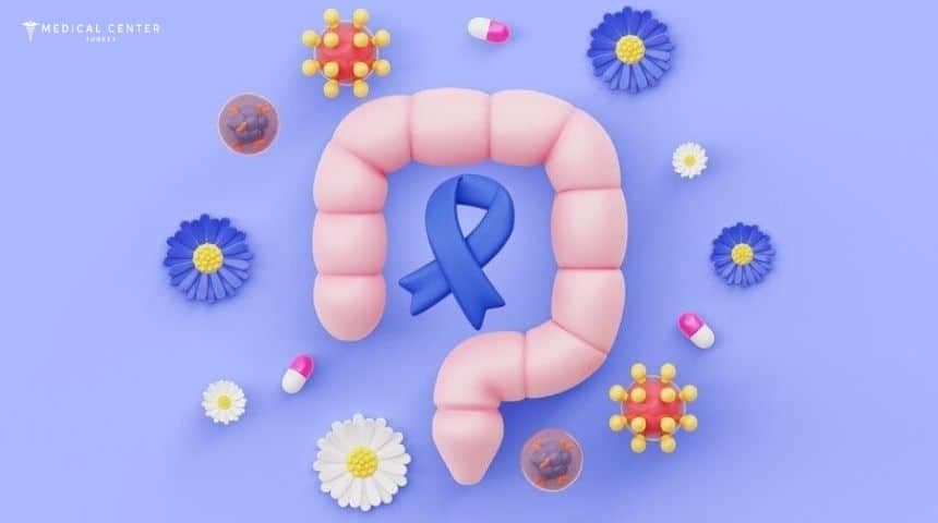 Radiation Therapy for Colorectal Cancer