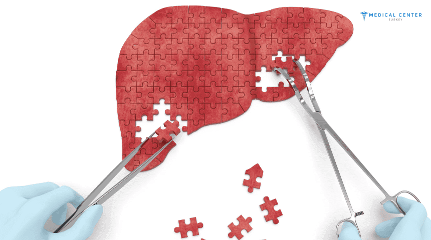 Removal of Liver Cancer