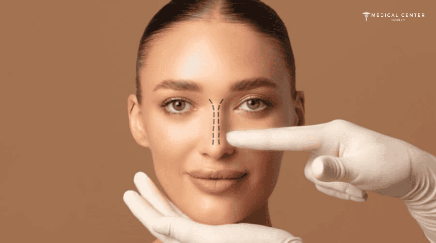 Rhinoplasty Techniques: Open VS Closed Surgery