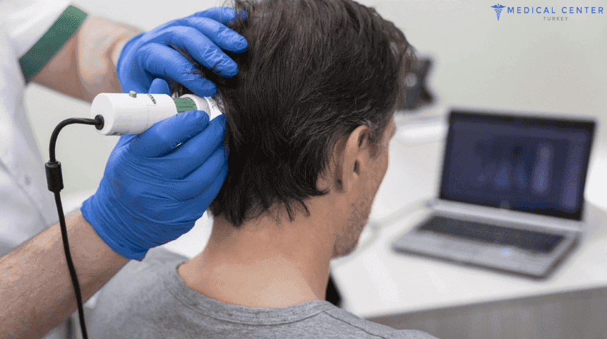 Robotic Hair Transplant Surgery in Turkey