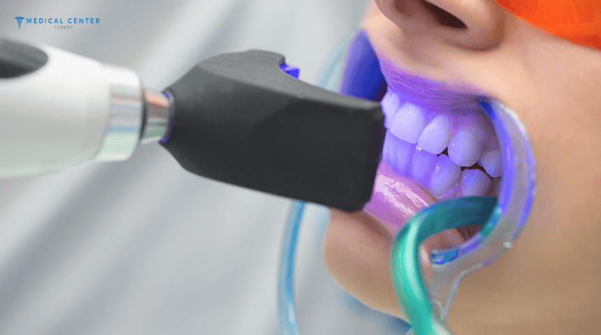 Teeth Whitening in Turkey