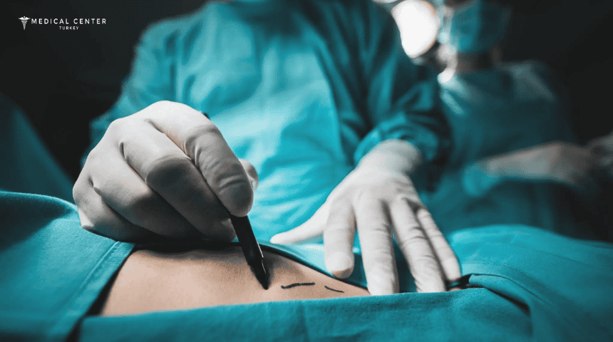 The Best Hospital for Liposuction in Turkey