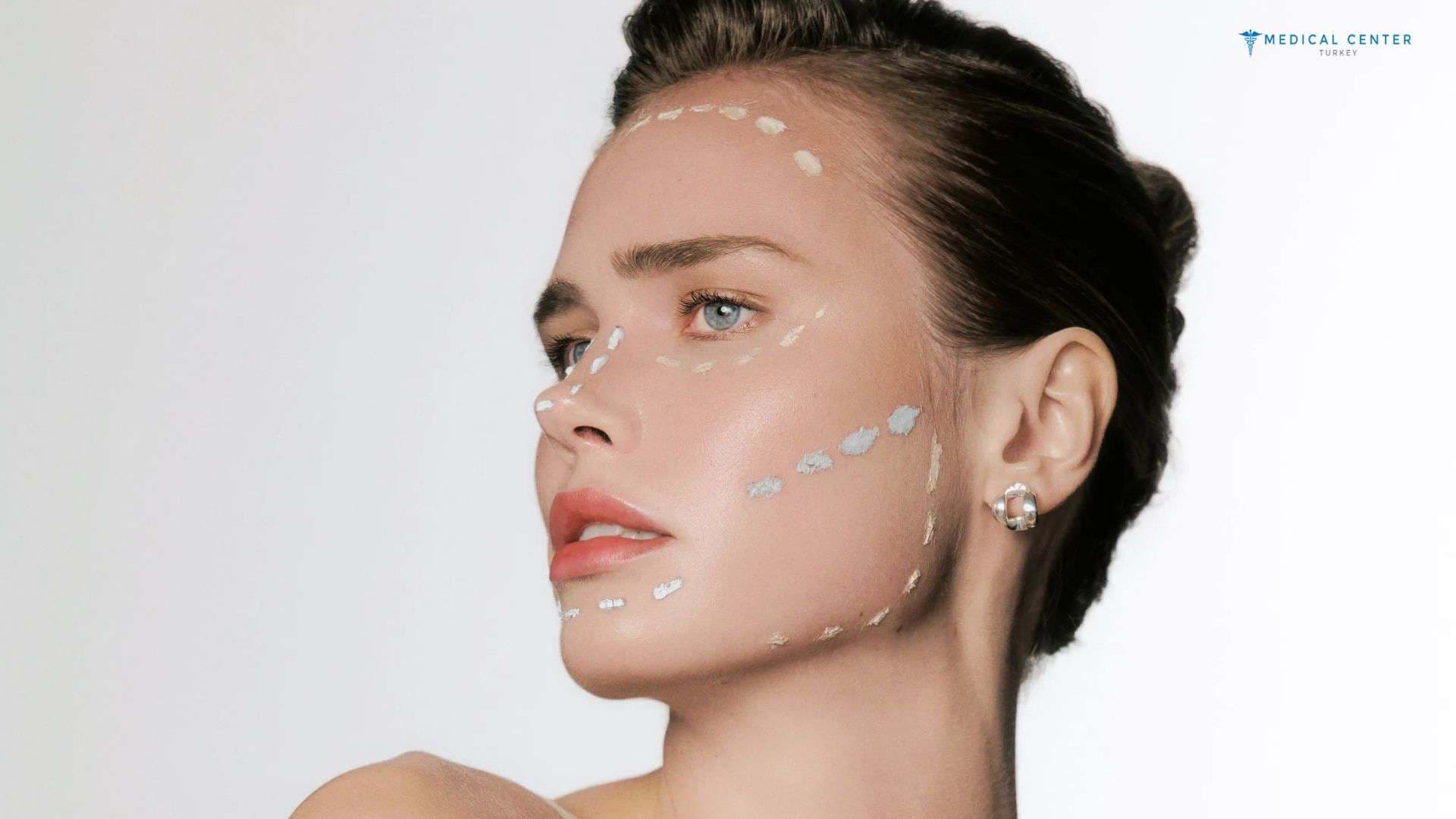 The Complete Guide to Facelift Surgery