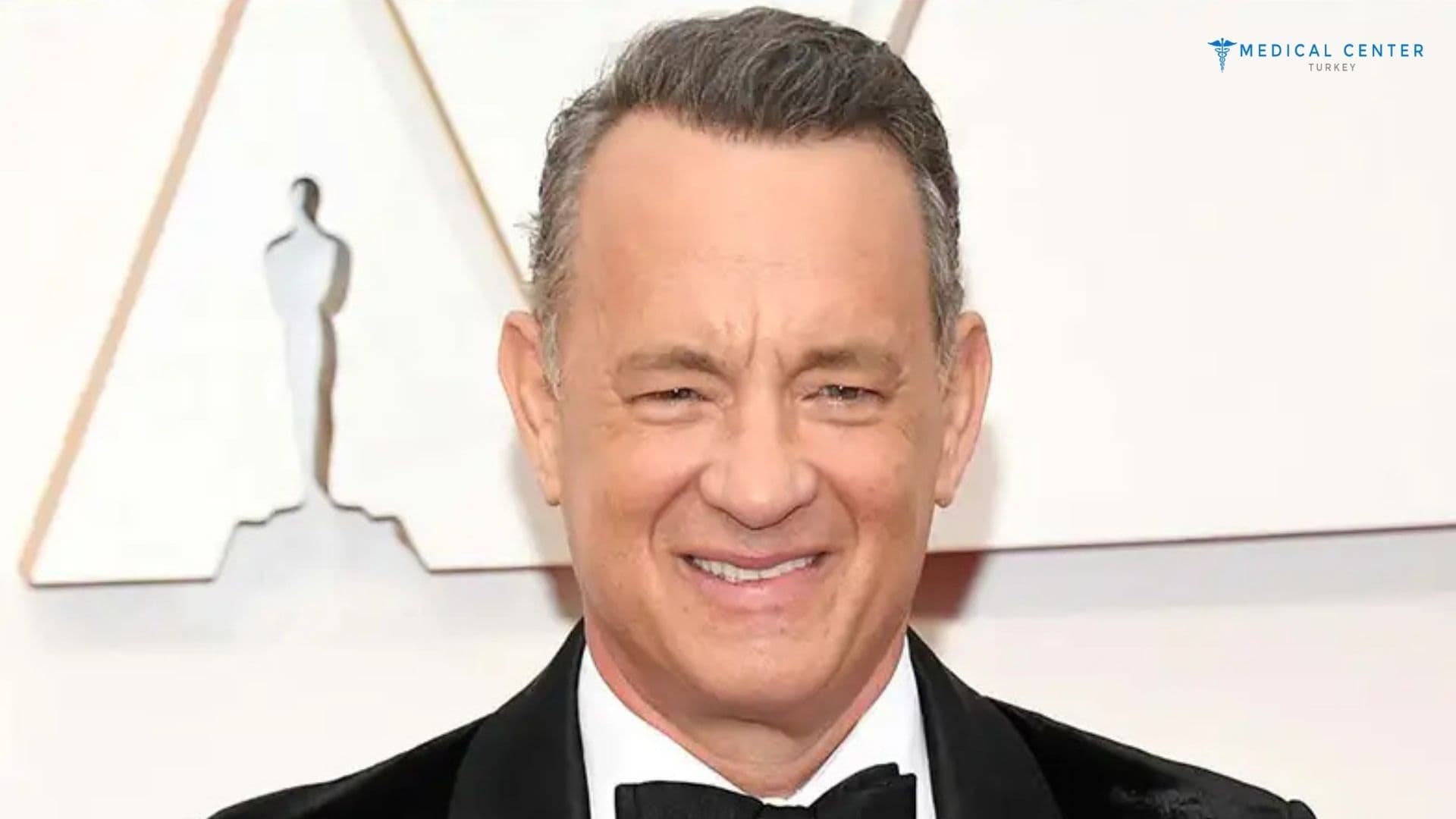 Tom Hanks' Hair Transplantation