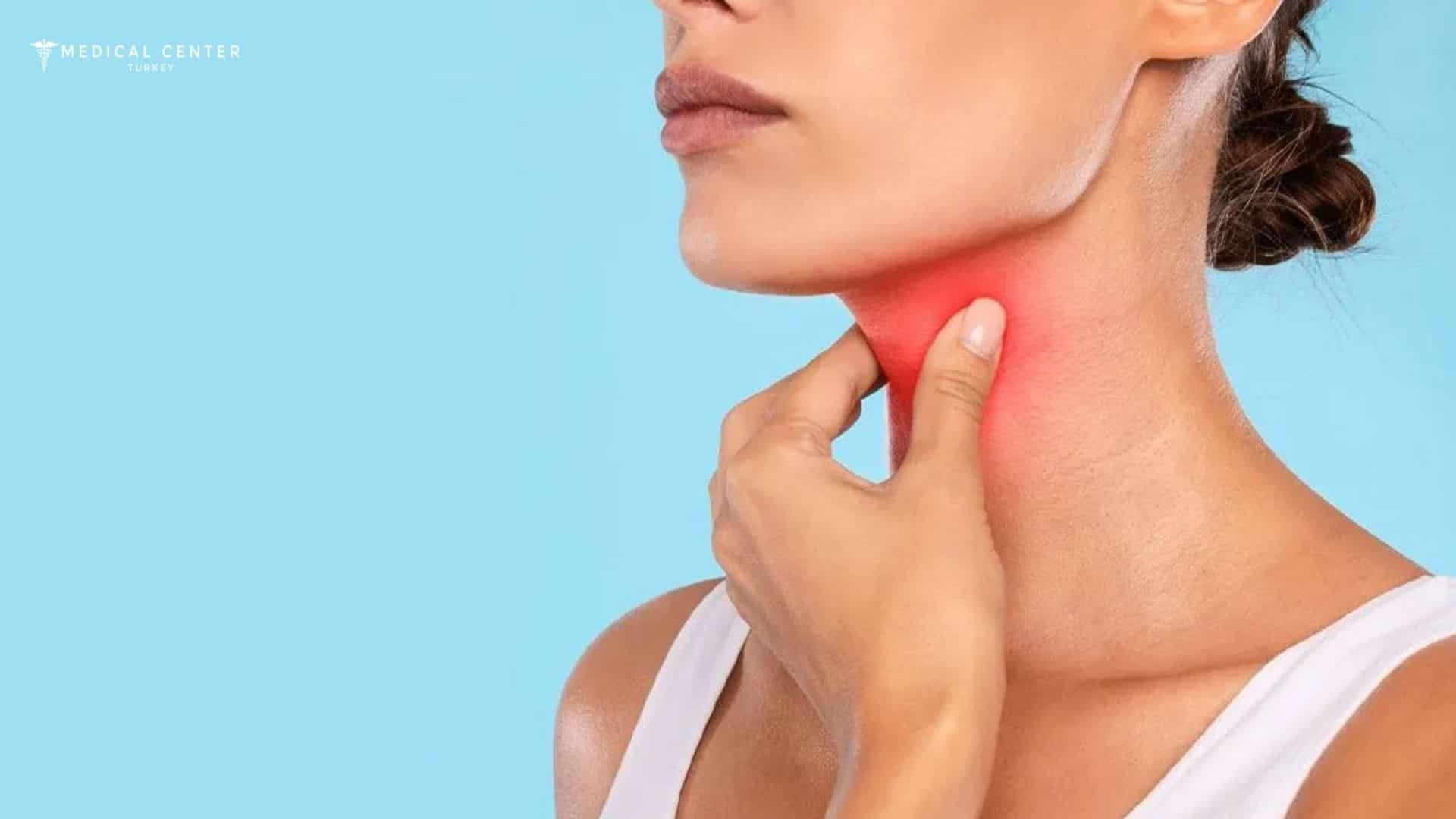 Tonsil Cancer