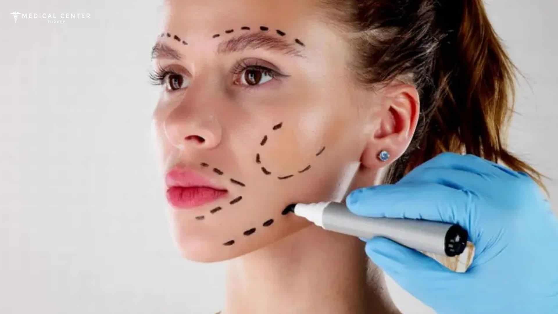Top 5 Trending Cosmetic Surgeries You Should Know About in Turkey