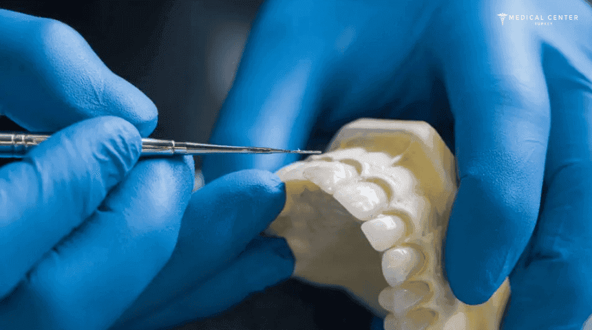 Transform Your Smile With Dent Restoration
